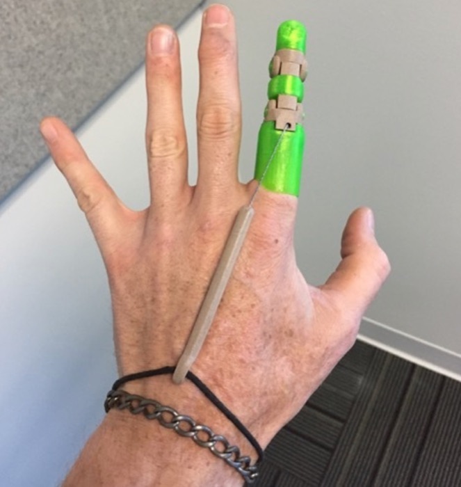 Knick Finger